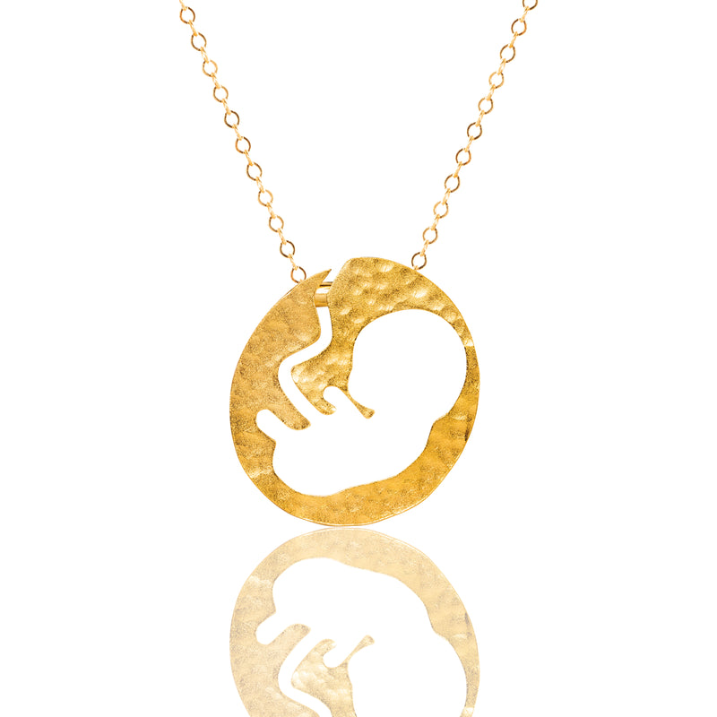 A gold chain passes through the womb
